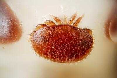 Varroa-Milbe in Vergerung: Man erkennt ein rtlichen Krper mit feinen Haaren und  dahinter sieht man Glieder einer Bienennymphe